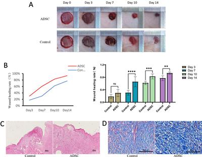 Therapeutic potential of ADSCs in diabetic wounds: a proteomics-based approach